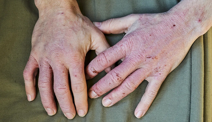 black seed oil health benefits,nigella sativa oil benefits,anti-inflammatory properties of black seed oil,antioxidant properties of black seed oil,black seed oil for respiratory problems,black seed oil for digestive issues,black seed oil for skin disorders,immune-boosting properties of black seed oil,heart-healthy properties of black seed oil,black seed oil for healthy hair and skin,anti-bacterial properties of black seed oil,antifungal properties of black seed oil,black seed oil for weight loss,black seed oil for diabetes management.
black seed oil for reducing the risk of cancer