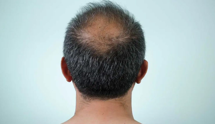 black seed oil,black seed oil for hair,hair care tips,beauty benefits of black seed oil,beauty tips