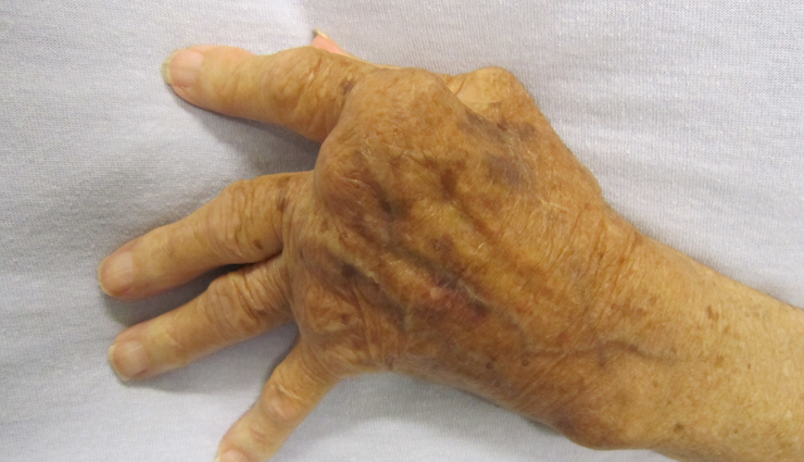 black seed oil,health benefits of black seed oil,Health tips,fitness tips