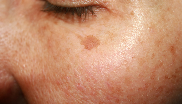 potato juice for beauty,benefits of potato juice for skin,beauty uses of potato juice,potato juice skincare benefits,how potato juice enhances beauty,potato juice for radiant skin,beauty benefits of using potato juice,potato juice for glowing skin,natural beauty benefits of potato juice,potato juice remedies for beauty