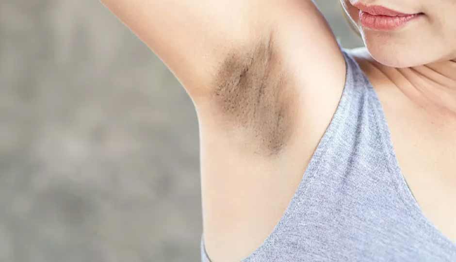 5 Home Remedies To Treat Black Underarms