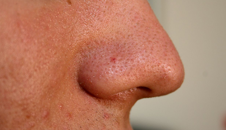 multani mitti face pack,multani mitti in english,multani mitti for hair,multani mitti ke fayde,multani mitti for acne,multani mitti benefits,multani mitti and curd for hair,multani mitti and curd,multani mitti and rose water,multani mitti and honey,multani mitti and honey face pack,how to make a multani mitti face pack,how to make a multani mitti,multani mitti benefits for hair,multani mitti benefits for face,multani mitti can be used daily,multani mitti contains,can multani mitti remove acne scars,can multani mitti remove tan,can multani mitti remove acne,can multani mitti remove pimple marks,can multani mitti be used daily,can multani mitti whiten skin,can multani mitti increase pimples,multani mitti daily,multani mitti dahi face pack,multani mitti daily use,multani mitti dry skin,multani mitti diy face pack,multani mitti for face,multani mitti for hair growth,multani mitti good for hair,multani mitti good for oily skin