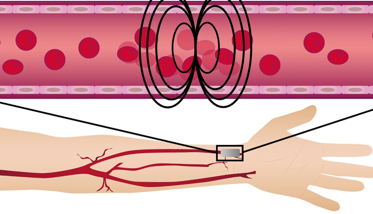 blackberry,health benefits of blackberry,Health tips,fitness tips