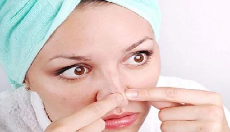 ये घरेलू नुस्खे दिलाएंगे जिद्दी 'ब्लैकहेड्स' से छुटकारा, आजमाते ही दिखने लगेगा असर
