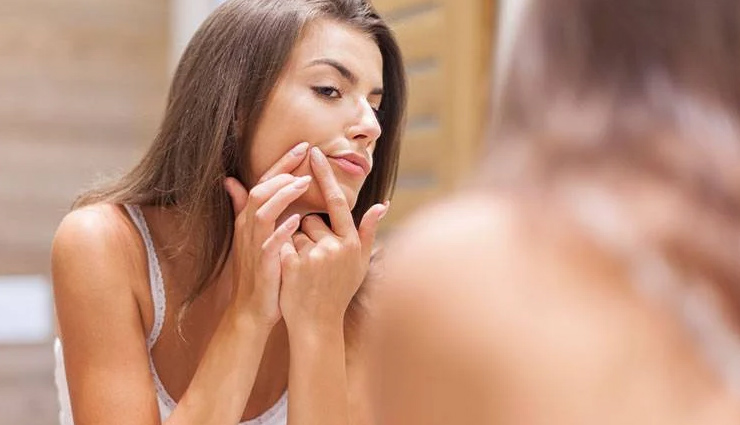 5 Natural Ways To Treat Blackheads