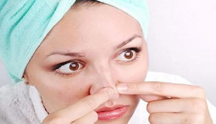Summer Special : पाना चाहते हैं ब्लैकहेड्स से छुटकारा, आजमाए ये कारगर उपाय