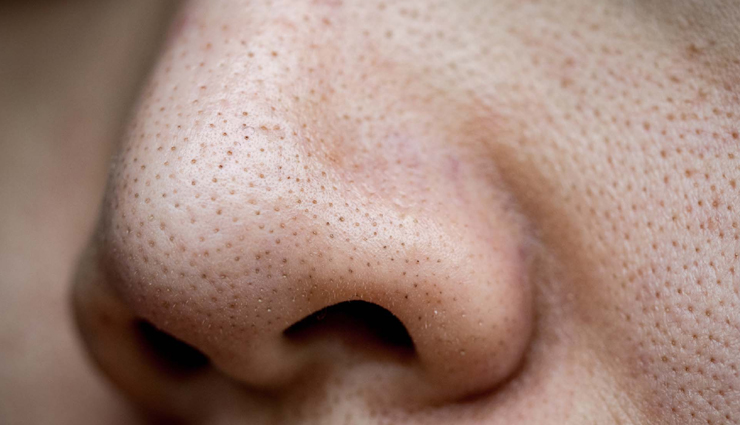 Try These 8 Homemade Scrubs To Remove Blackheads