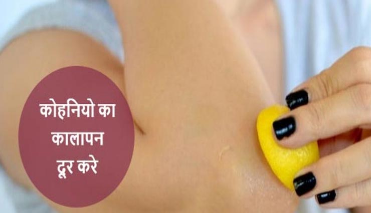 क्या आपको भी शर्मिंदा कर रहा हैं घुटनों व कोहनियों का कालापन, इन नुस्खों से पाएं सुंदरता