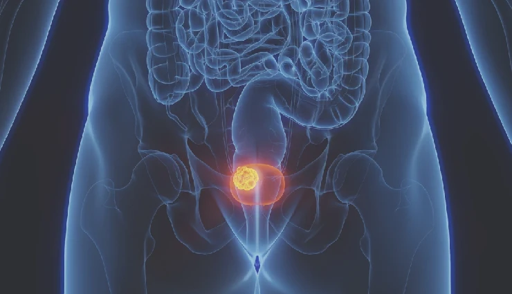 types of cancer,most common cancers,breast cancer,lung cancer,blood cancer,colon cancer,prostate cancer,cancer effects on body,causes of cancer,cancer risk factors,cancer fatality rate,cancer awareness,abnormal cell growth,cancer treatment,cancer impact on organs