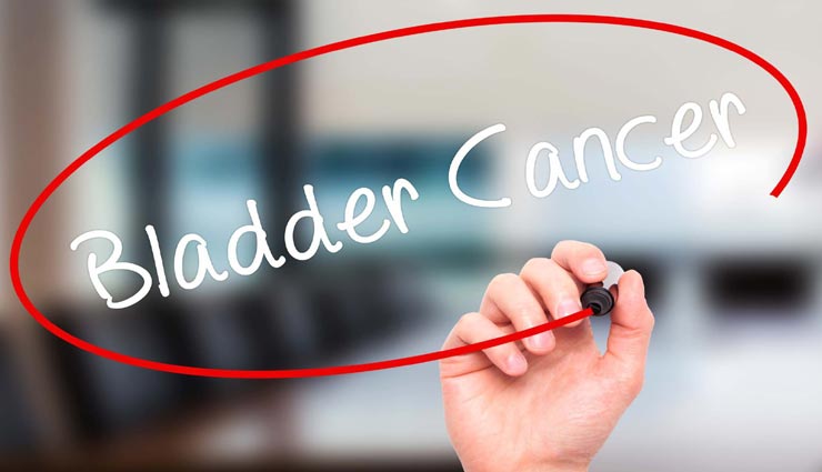 Health tips,health tips in hindi,bladder pain,bladder pain indicate problems,healthy life