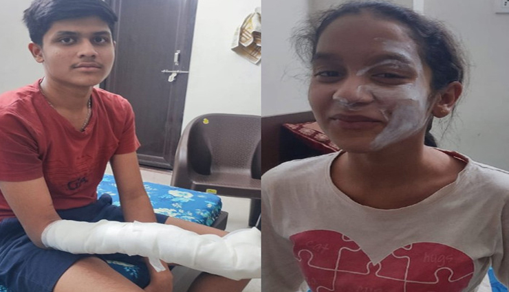 कोटा : MI मोबाइल की बैटरी फटने से हुआ हादसा, पड़ोसियों ने भी सुना धमाका, झुलसे बहन और भाई 