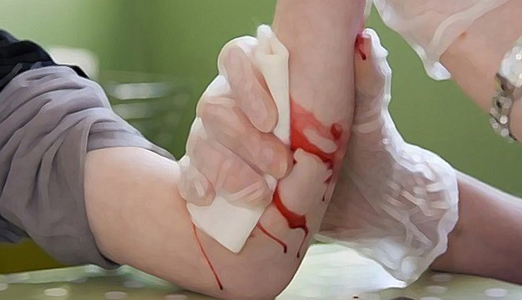 Health tips,healthy living,understanding basic first aid,how to give basic first aid,basic first aid during accidents,first aid tips