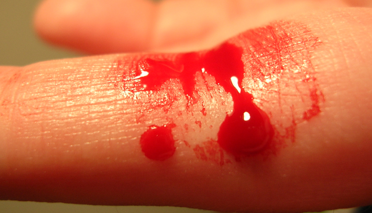 side effects of chia seeds,chia seed side effects,risks of eating chia seeds,potential side effects of chia seed consumption,chia seed drawbacks and side effects,negative effects of eating chia seeds,adverse reactions to chia seeds,chia seed health risks,possible side effects of chia seed consumption,chia seed side effects and precautions