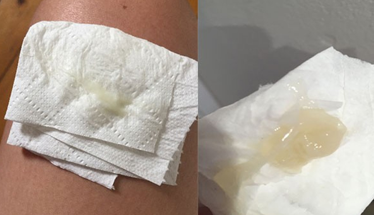 spotting during pregnancy,pregnancy tips,Health tips,fitness tips