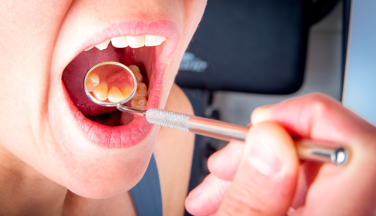 oral health care tips,dental care advice,tips for healthy teeth,oral hygiene tips,dental health recommendations,best practices for oral care,tips for strong teeth and gums,maintaining oral hygiene,dental health habits,oral care guidelines,brushing techniques for teeth,flossing tips for oral health,mouthwash benefits and usage,preventing gum diseases,oral care for fresh breath,diet and dental health,dental check-up importance,dental care for children,natural remedies for oral health,daily oral care routine,tips for cavity prevention,dental care for sensitive teeth