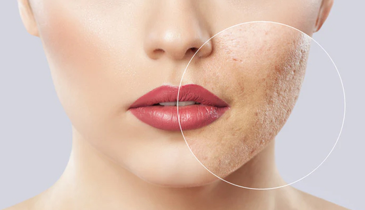 yogurt face mask benefits,skincare with yogurt,natural face remedies,yogurt for glowing skin,diy yogurt face mask,skin hydration with yogurt,beauty benefits of yogurt,homemade yogurt skincare,clear skin with yogurt,nourishing face masks,yogurt beauty hacks,anti-aging yogurt mask,clear complexion with yogurt,acne-free skin with yogurt,brightening face mask,yogurt for blemish-free skin,natural skin remedies,yogurt skincare routine,organic face treatments,soothing yogurt masks,diy beauty secrets,skin rejuvenation with yogurt,healing properties of yogurt,youthful skin with yogurt,probiotics for skin health