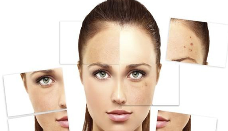 dark circles,acne,the best concealer for every skin problem,blemishes,redness