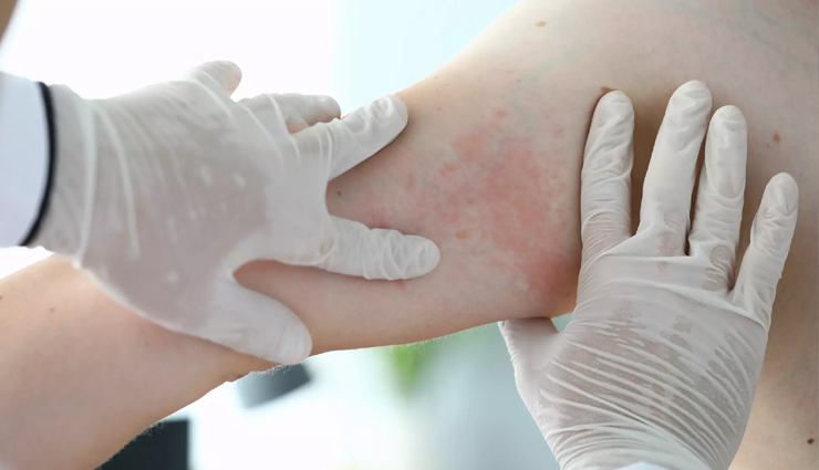 harmful effects of laser hair removal,risks of laser hair removal,dangers of laser hair removal,side effects of laser hair removal,is laser hair removal safe?,laser hair removal and skin damage,skin risks with laser hair removal,health concerns of laser hair removal,laser hair removal drawbacks,complications of laser hair removal,laser hair removal safety issues,skin damage from laser hair removal,negative impacts of laser hair removal,laser hair removal and skin sensitivity,allergic reactions to laser hair removal,skin irritation from laser hair removal,skin discoloration and laser hair removal,laser hair removal and scarring,burns from laser hair removal,laser hair removal and long-term effects,alternatives to laser hair removal
safe hair removal methods,best practices for hair removal,skin care after laser hair removal,consultation before laser hair removal