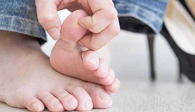 blisters,home remedies,home remedies for blisters,Health tips,fitness tips