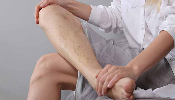 Reasons Why Vitamins are Important For Blood Circulation in Legs