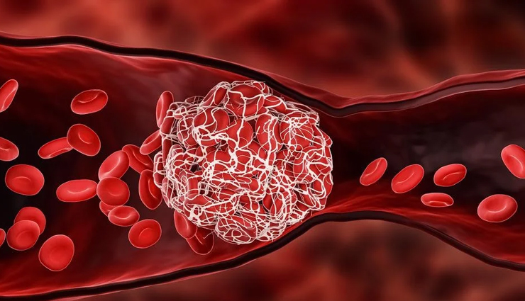 feverfew health benefits,natural remedies with feverfew,feverfew for migraines and headaches,anti-inflammatory properties of feverfew,feverfew and skin care,feverfew for menstrual issues,feverfew and arthritis relief,feverfew and cancer research,how to use feverfew effectively,feverfew dosage and safety