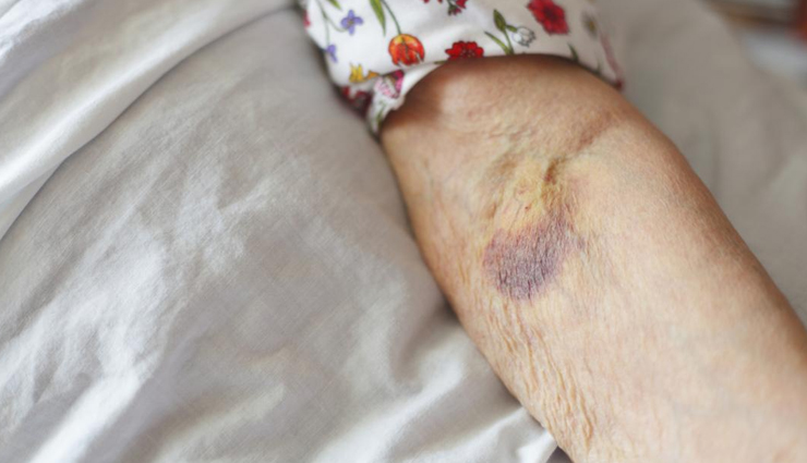 g benefits of adding moringa to your smoothie for your health,healthy living,Health tips