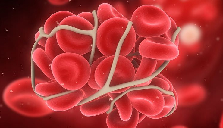 हद से ज्यादा ना करें प्रोटीन पाउडर का सेवन, हो सकते हैं ये साइड इफेक्ट protein powder side effects,side effects of protein powder,protein powder negative effects,common side effects of protein powder,health risks of protein powder,protein powder and digestive issues,protein powder and kidney damage,protein powder and liver health,protein powder side effects and health risks,side effects of different protein powders,best protein powder with fewer side effects,health news,latest health news,recent health news updates,health news today,health news headlines,health news and trends