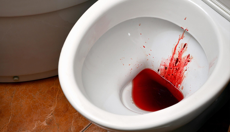 9 Natural Remedies to Treat Blood in Stool and Promote Digestive Health