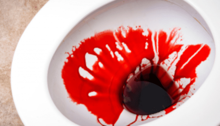 early signs of bowel cancer,symptoms of colorectal cancer,bowel cancer warning signs,blood in stools bowel cancer,abdominal pain cancer symptom,unexplained weight loss cancer,bowel cancer detection,colorectal cancer symptoms,early bowel cancer indicators,when to see a doctor for bowel issues