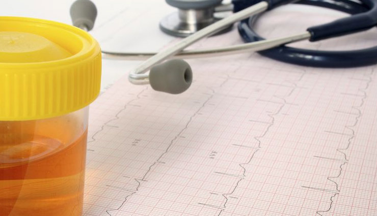 blood in urine,Health tips