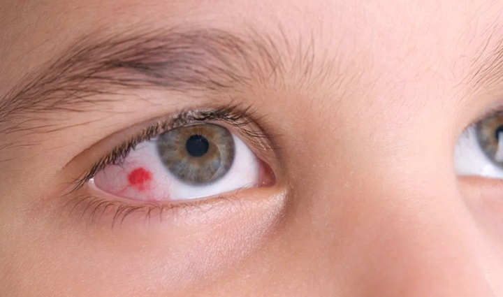 the problem of high blood pressure can push a person towards death be alert as soon as these symptoms appear,Health,healthy living