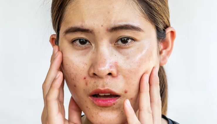 home remedies for blotchy skin,uneven skin tone treatments,natural remedies for skin discoloration,reduce blotchy skin,remedies for skin redness and irritation,remedies for eczema,psoriasis treatment,soothing blotchy skin,skin care for blotchy skin,even out skin tone,natural skin treatments