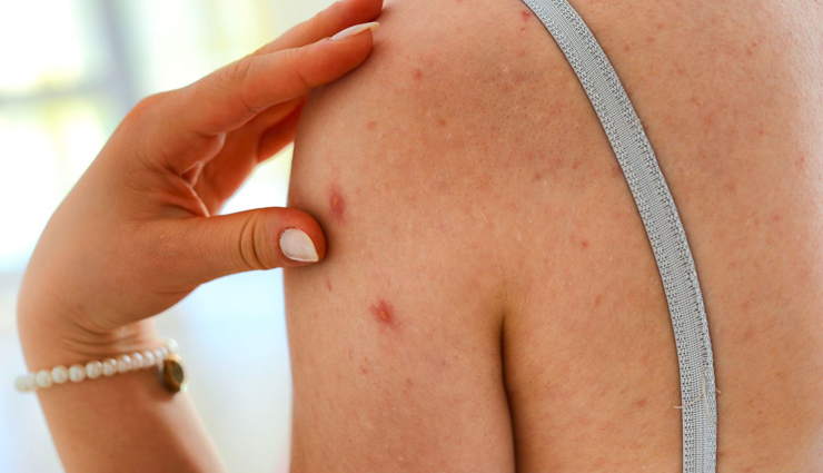 body care mistakes to avoid,common body care errors,avoiding mistakes in skincare routine,tips to prevent body care blunders,mistakes to steer clear of in body care,body care dos and donts,best practices for effective body care,ensuring proper body care routine,body care pitfalls to stay away from,common body care missteps to dodge,maximizing your body care routine,body care mishaps to be aware of,achieving optimal results in body care,proper body care techniques to follow,enhancing your body care regimen,preventing errors in body care routine,expert advice on body care mistakes,tips for successful body care routine,body care tips for avoiding mistakes,mistakes in body care to be mindful of