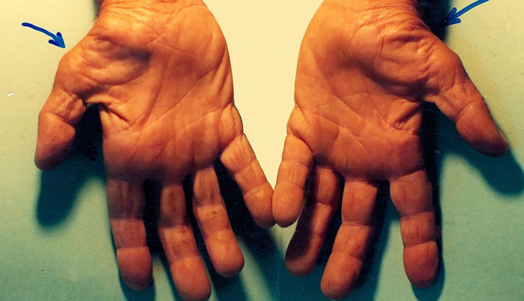 easing body pain due to aging,remedies for body pain,aging health tips,fitness tips,carpal tunnel,lower back pain,pelvic pain,headaches,chest pain,joint stiffness