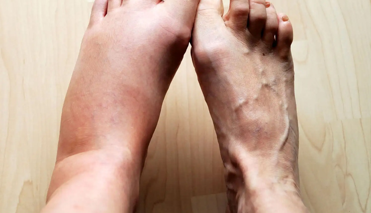 जामुन ही नहीं इसकी गुठली भी है बड़ी कमाल की, डायबिटीज होगी कंट्रोल, चूर्ण बनाकर खाने से मिलेंगे चौकाने वाले फायदे jamun seeds health benefits,benefits of eating jamun seeds,jamun seeds nutrition facts,health advantages of jamun seeds,uses of jamun seeds for health,jamun seed benefits for the body,jamun seed extract benefits,jamun seed consumption benefits,jamun seeds medicinal properties,jamun seed antioxidants,जामुन के बीज के स्वास्थ्य लाभ,जामुन के बीज के फायदे,जामुन के बीज के गुण,जामुन के बीज के उपयोग,जामुन के बीज के खाने के फायदे,जामुन के बीज के स्वास्थ्य प्रभाव,जामुन के बीज के औषधीय गुण,जामुन के बीज के लाभ,जामुन के बीज के उपाय,जामुन के बीज के औषधीय प्रयोग