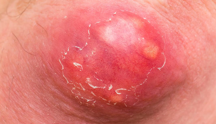 cumin seeds,beauty benefits of cumin seeds,amazing beauty benefits of cumin seeds,jeera benefits,jeera beauty benefits,beauty,beauty benefits,jeera for hair,cumin seeds for skin,cumin seeds for hair loss