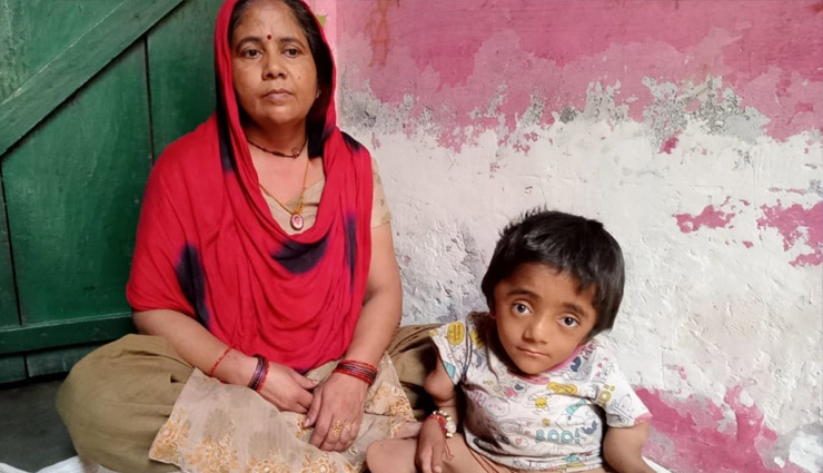 अलीगढ़: गोद में उठाते ही टूट जाती है इस बच्चे की हड्डियां, मां ने इलाज के लिए लगाई मदद की गुहार