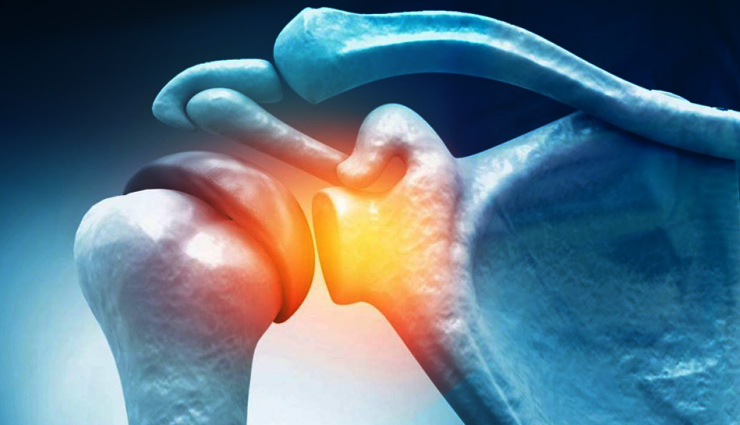 curd,curd problem on skin,skin care tips,skin care,beauty,beauty tips