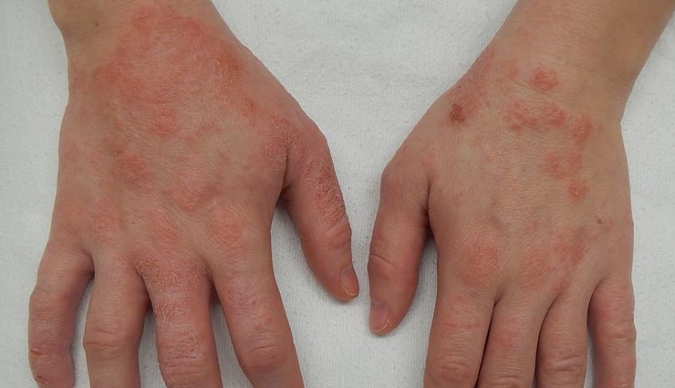 borage oil,health benefits of borage oil,Health tips,fitness tips