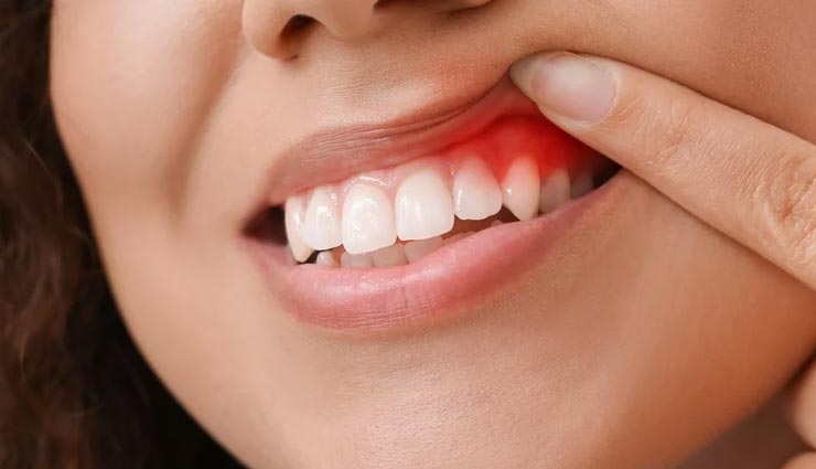 borage oil,health benefits of borage oil,Health tips,fitness tips