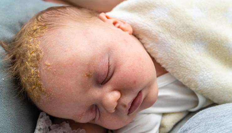 borage oil,health benefits of borage oil,Health tips,fitness tips