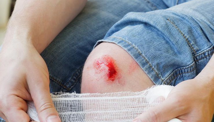 brahmi powder,health benefits of brahmi powder,Health tips,fitness tips