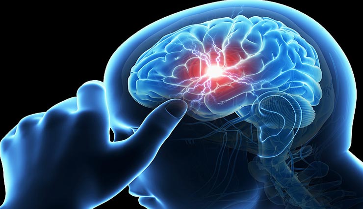 ब्रेन स्ट्रोक बनता है मौत का कारण, इन लक्षणों से लगाए समय रहते इसका पता