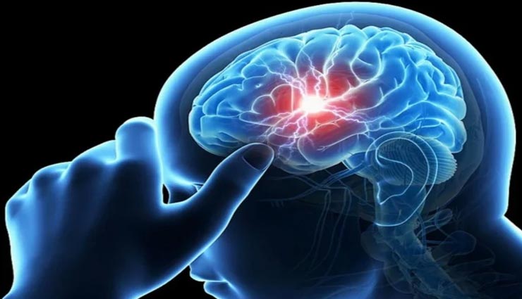 ब्रेन स्ट्रोक बन सकता हैं आपकी मौत का कारण, समय रहते लक्षणों को जान बरतें सावधानी