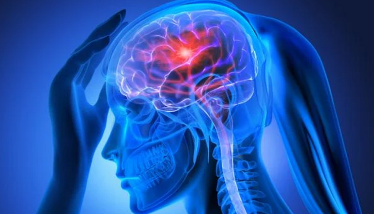 brain stroke causes and effects,understanding the impact of brain stroke,brain stroke prevention and treatment,brain stroke management for long-term disability,brain stroke risk factors and symptoms,managing brain stroke mortality rates,brain stroke awareness and education,brain stroke recovery and rehabilitation,brain stroke prevention strategies,brain stroke impact on quality of life