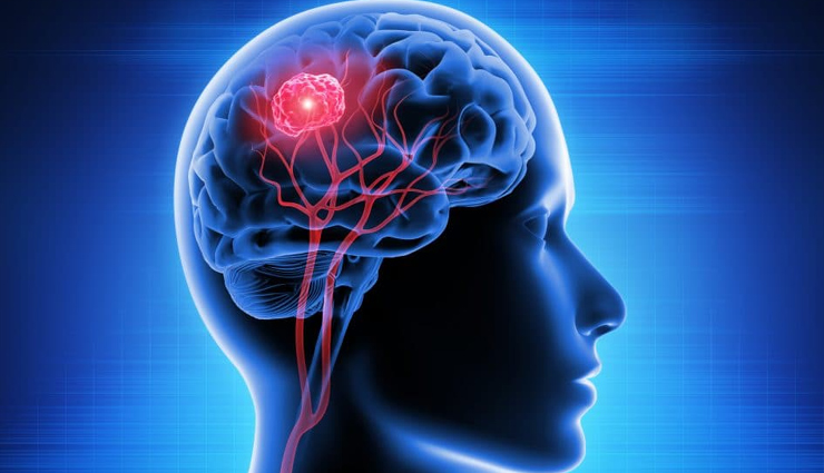 world brain tumor day theme 2022,world brain tumor day in india,world brain tumor day 2022,what were your first signs of a brain tumor,what is the main cause of brain tumors,what happens if you have a brain tumor,world brain tumor day 2022,Health tips,healthy living