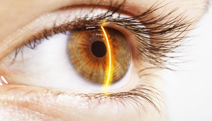 आँखें खोलती है आपकी सेहत का राज, इस तरह पता करे इनसे बीमारी का Health tips,health tips in hindi,health secret by eyes,disease symptoms by eyes