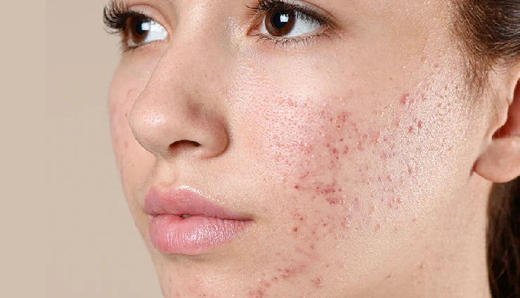 face oils,skincare myths,benefits of face oil,oily skin care,glowing skin tips,face oil for acne,face oil routine,natural skin elixirs,face oil daily use,myths about face oil