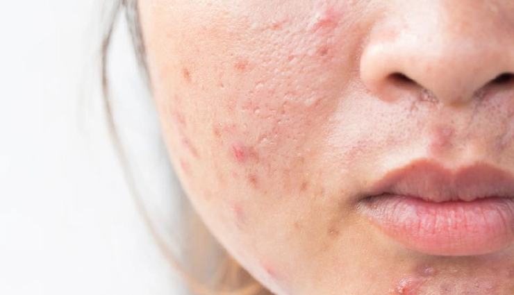 benefits of sleep for skin,sleep and skin health,how sleep affects skin,glowing skin tips,sleep for glowing skin,beauty sleep facts,skincare and sleep,why sleep is important for skin,sleep and anti-aging,skin healing during sleep,sleep deprivation skin effects,natural skincare tips,radiant skin secrets,how to get healthy skin naturally