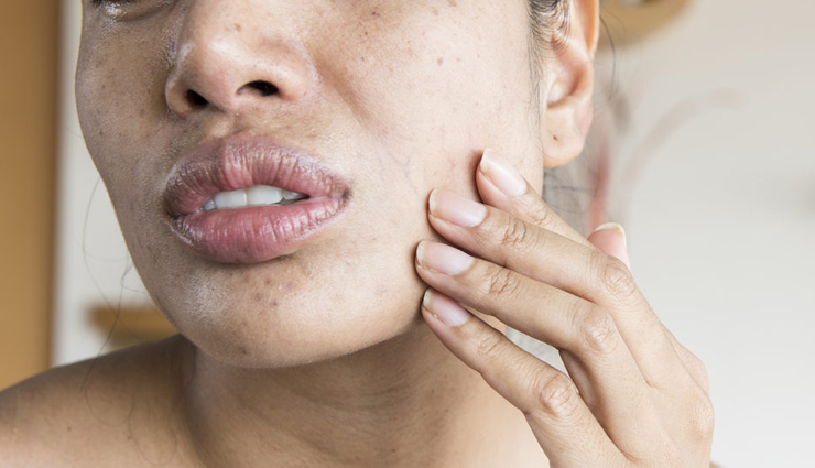 diy face masks,face masks for bride to be,skin care tips,beauty tips